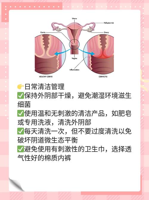 女性分泌物异常如何？揭秘日常护理与健康自测方法