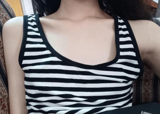 女性隆胸高清照无打码