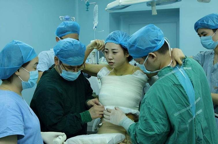 女性隆胸高清照无打码